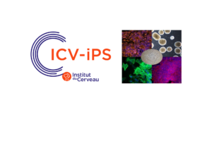 ICV-iPS