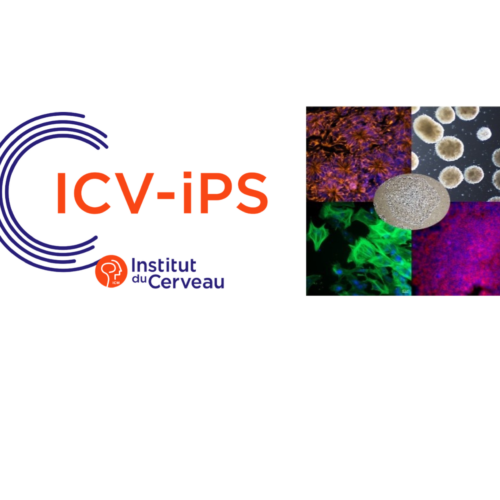ICV-iPS